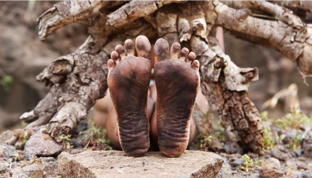Person lying on the ground showing the blackened soles of their feet
